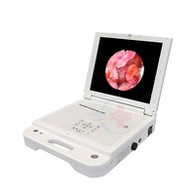 Cámara de endoscopia de artroscopio médico Ent